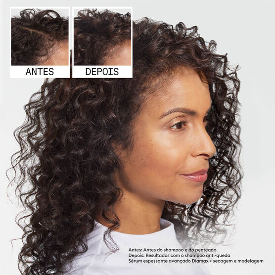 Shampoo Antiqueda Nioxin